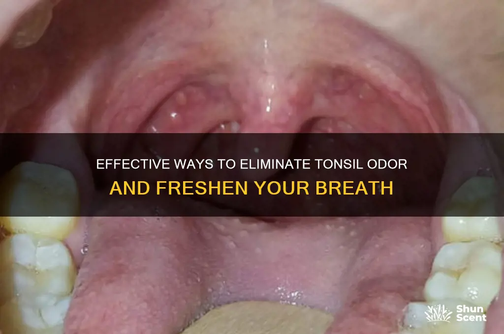 how to get rid of tonsil odor