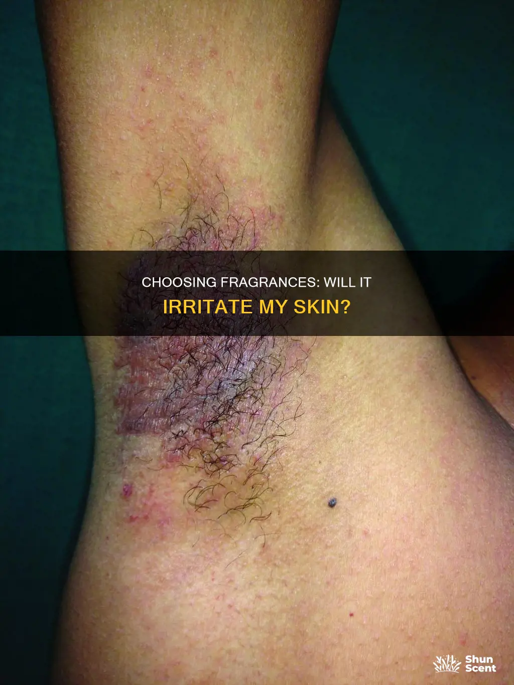 how to know if fragrance will irritate my skin