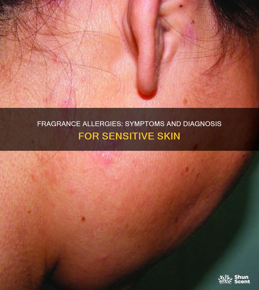 how to know if you are allergic to fragrance