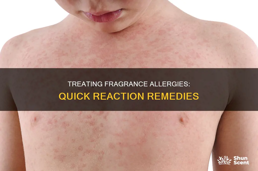 how to treat an allergies reaction to fragrance