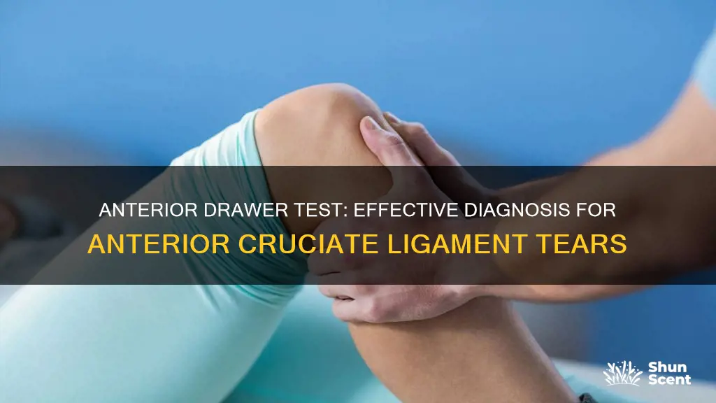 is an anterior drawer test for arom