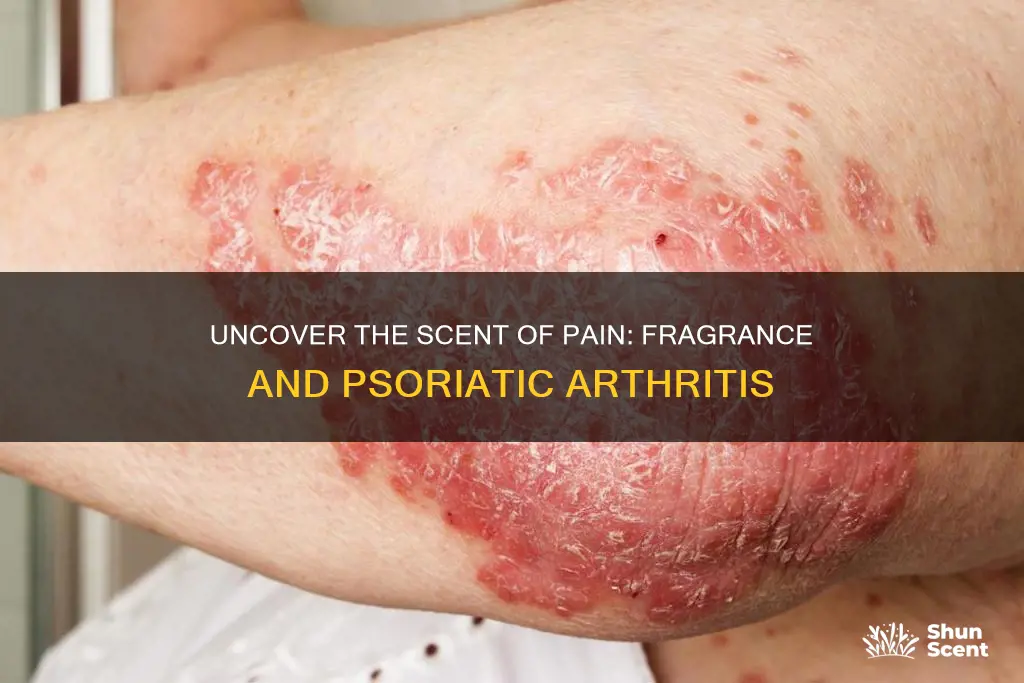 is fragrance a trigger for psoriatic arthritis