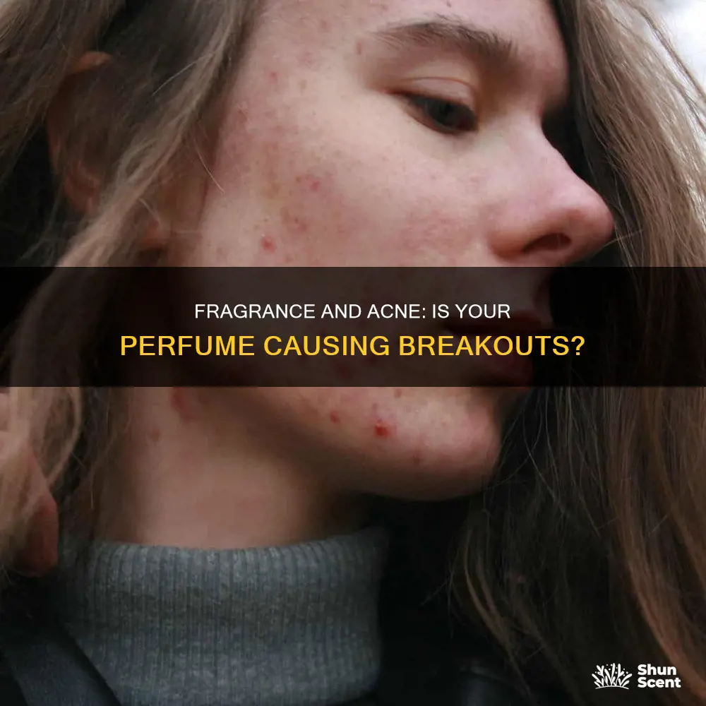 is fragrance bad for acne