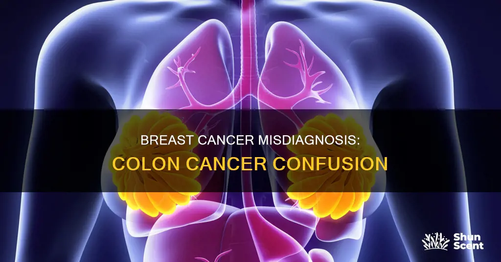 is my breast cancer really cologn cancer