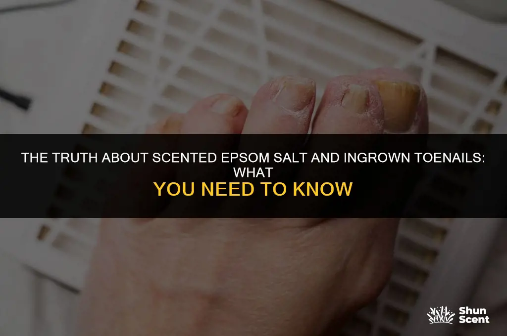 is scented epsom salt bad for ingrown toenails