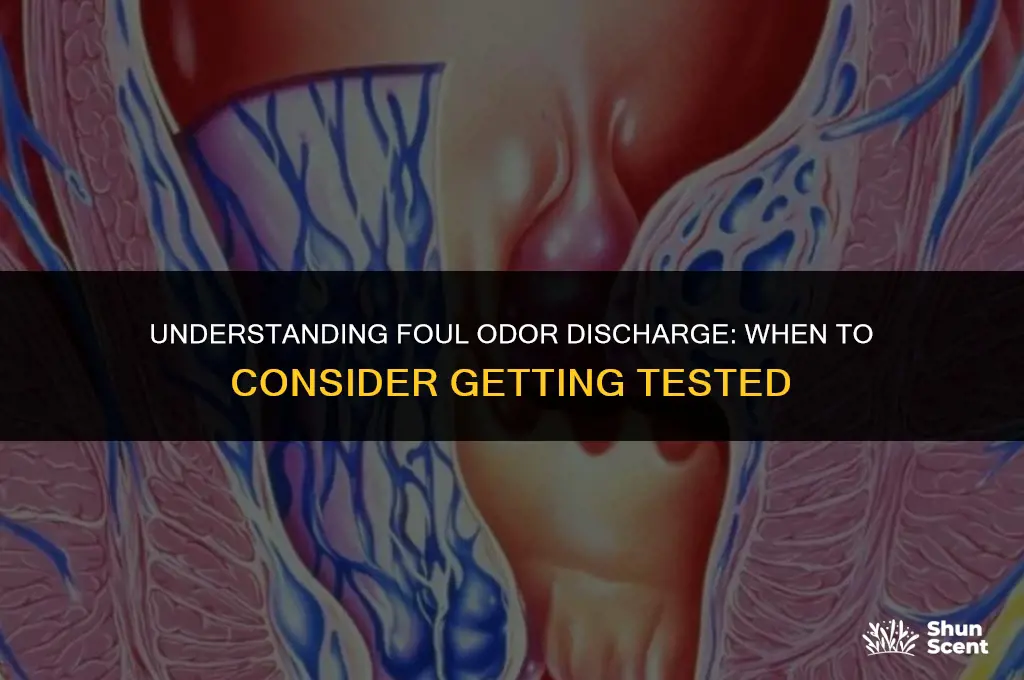 should you get tested if you have foul odor discharge