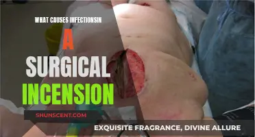 How Surgical Incisions Become Infected: Key Factors