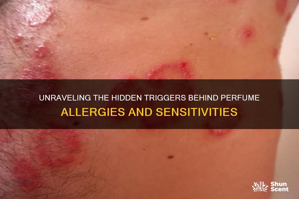 what causes perfume allergies