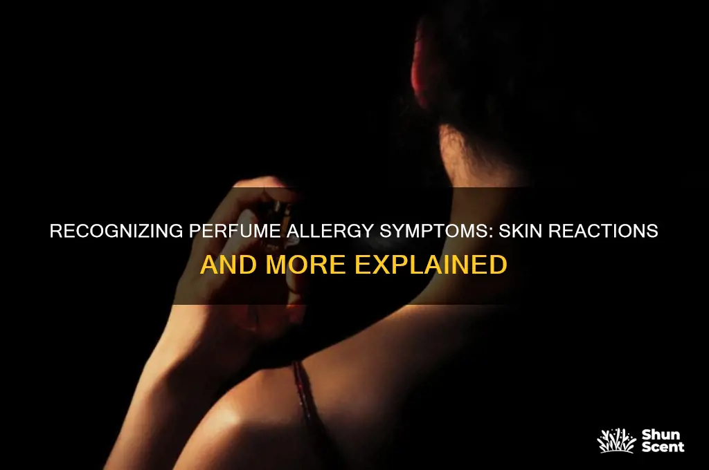 what does an allergic reaction to perfume look like