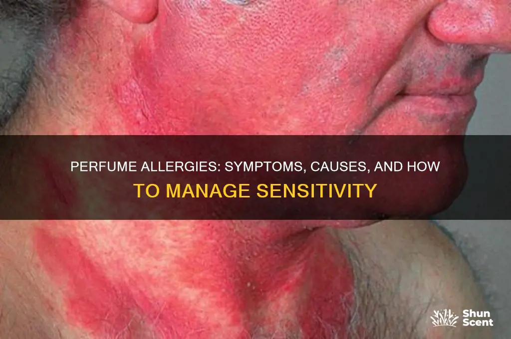 what happens if you are allergic to perfume