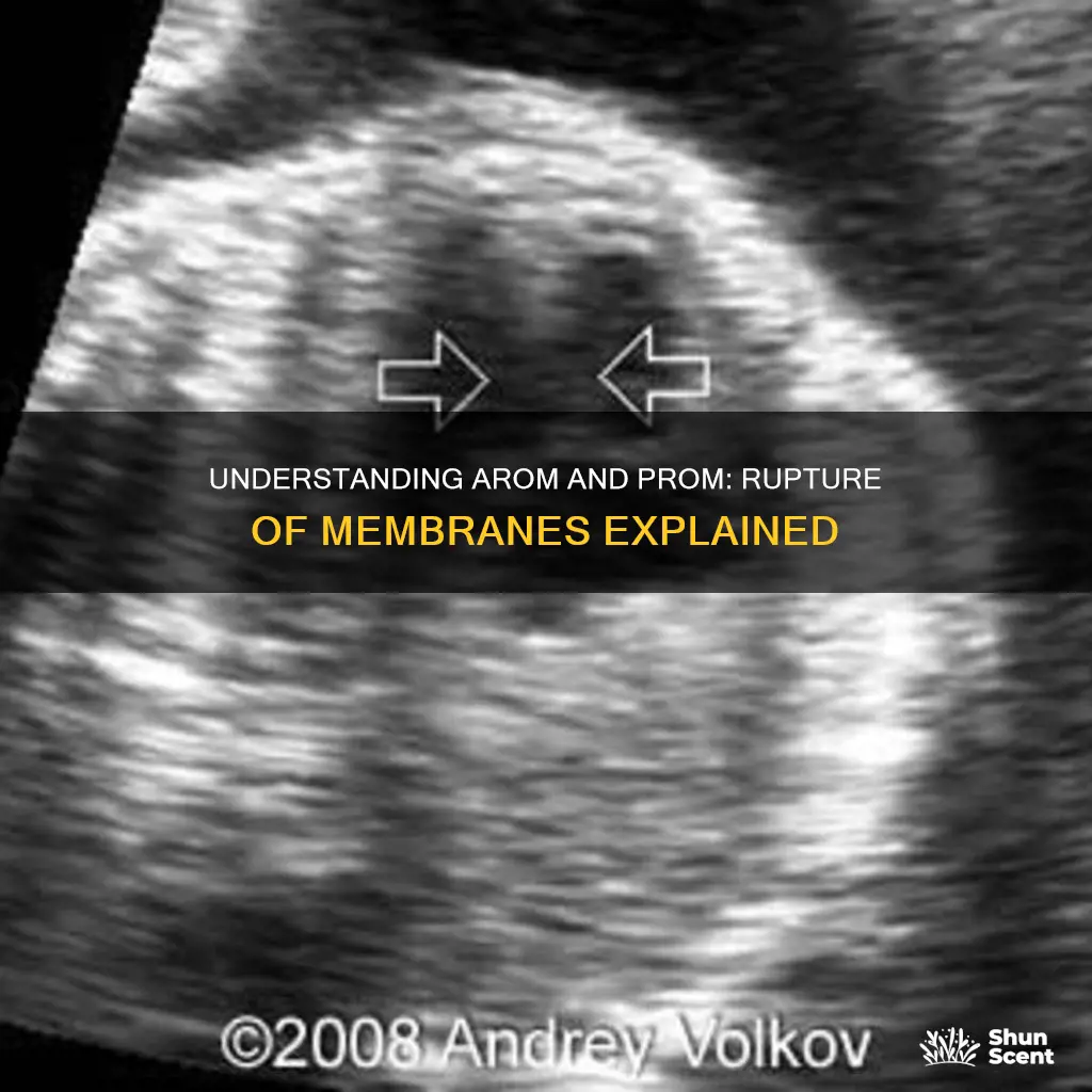 what is arom vs prom rupture of membranes