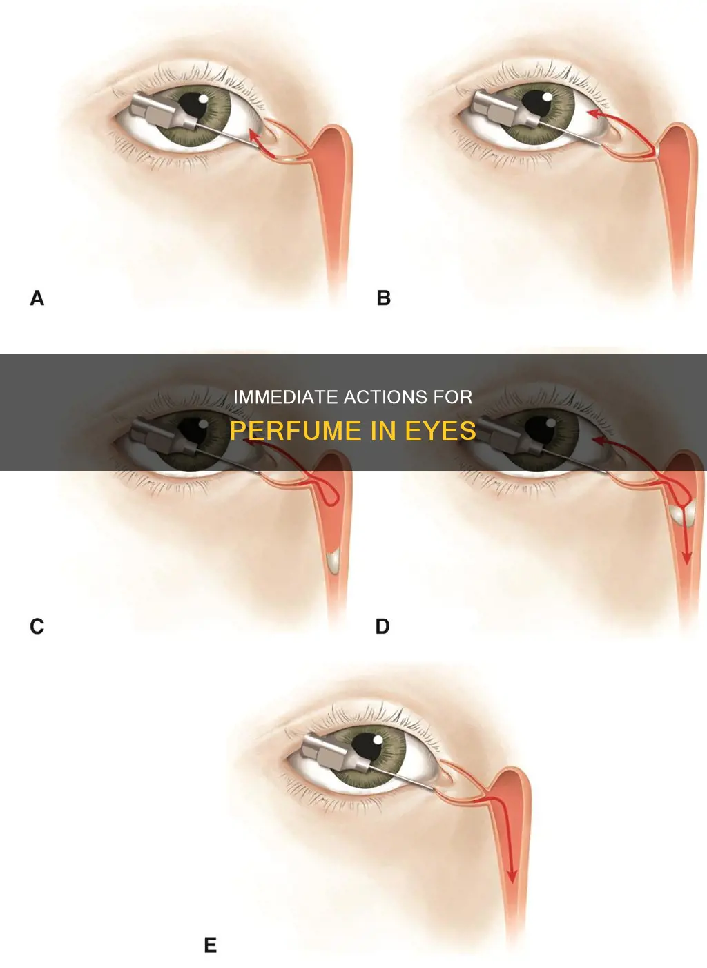 what to do when child sprayed perfume in eyes