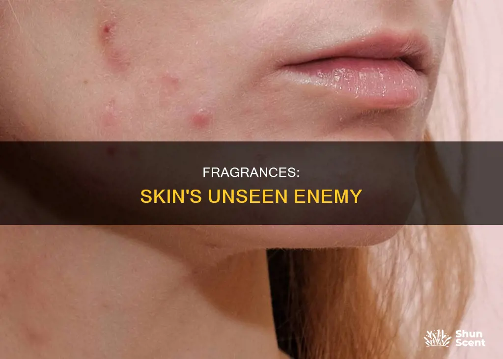 why are fragrances bad for skin