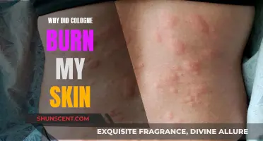 Cologne Chemistry: Burning Skin Reactions Explained