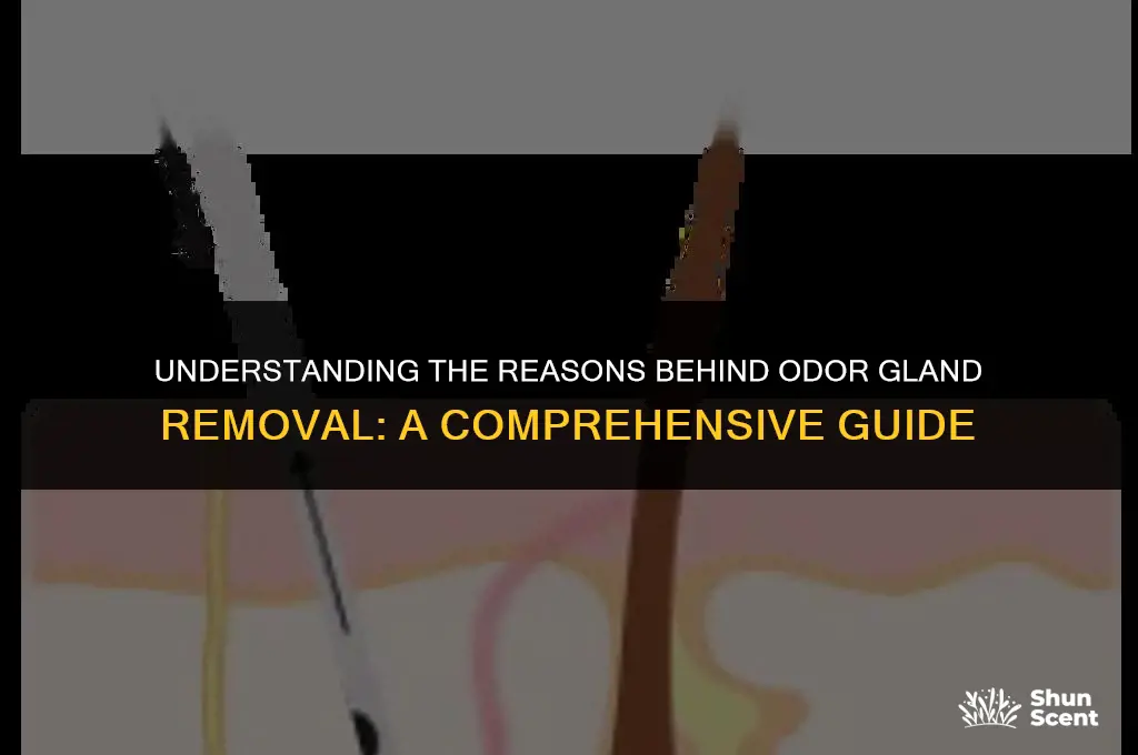 why do people get odor glands removed